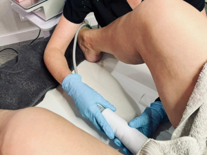 Vaginal HIFU treatment at London Body Clinic in London for non-surgical intimate rejuvenation