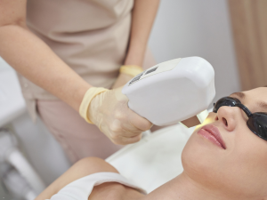 IPL facial vein removal treatment at London Body Clinic for visible facial veins, redness and broken capillaries