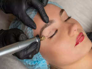 Plasma fibroblast skin tightening treatment at London Body Clinic for fine lines, wrinkles and loose skin