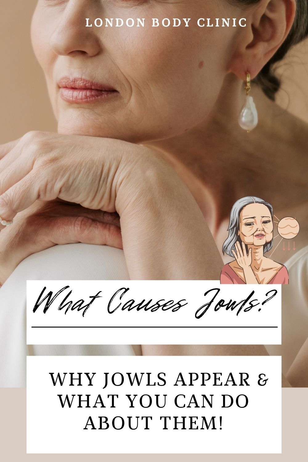 Jowls on the lower face showing sagging skin and reduced jawline definition